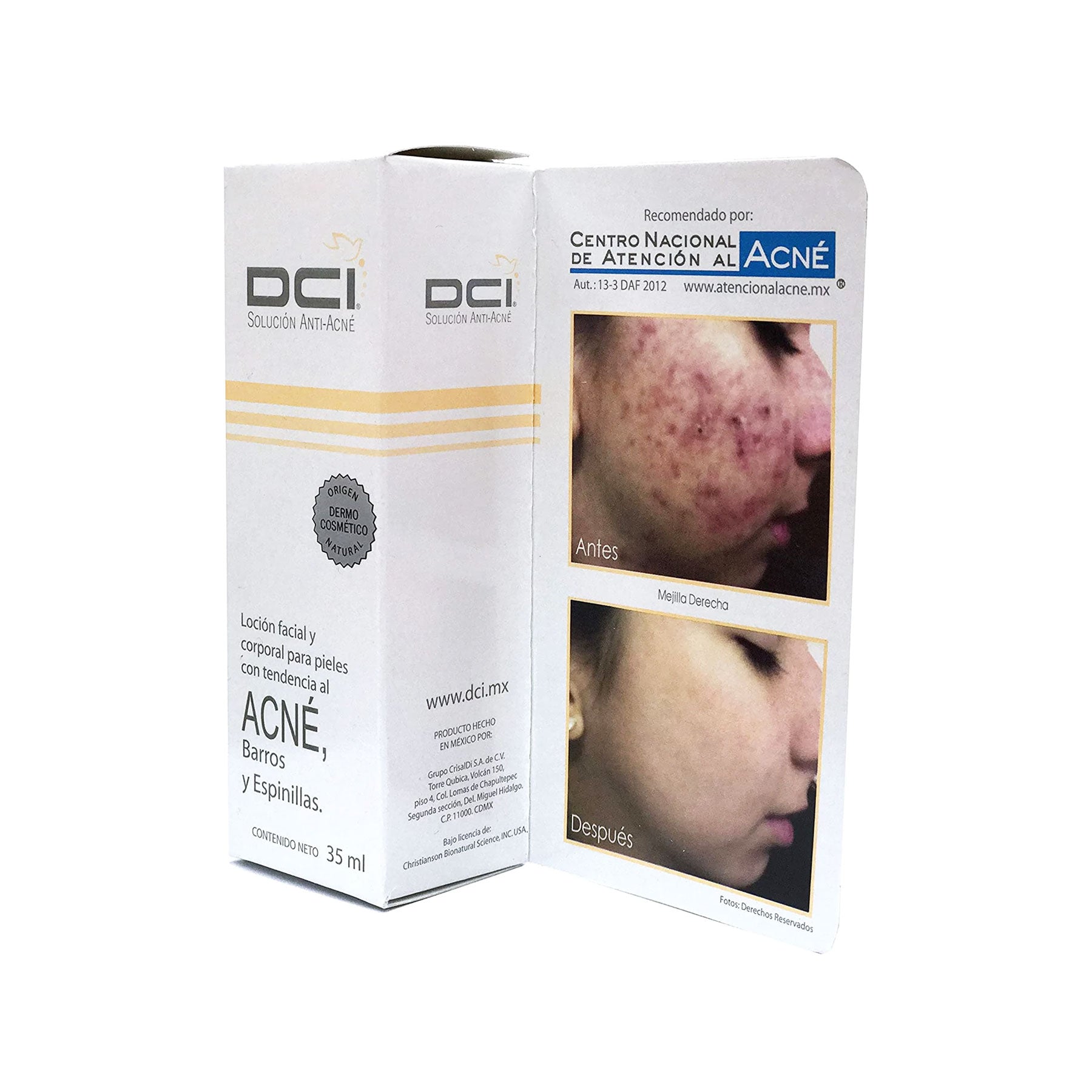 Solución Antiacné DCI 35 ml